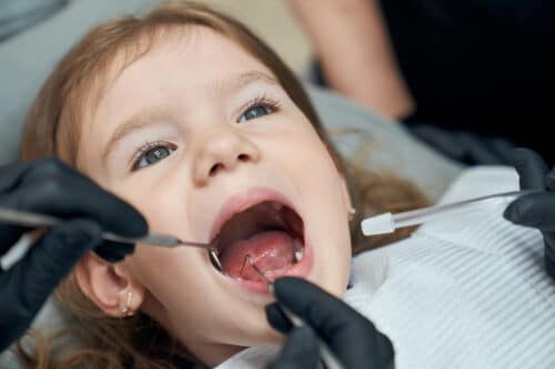 dental problems in toddlers