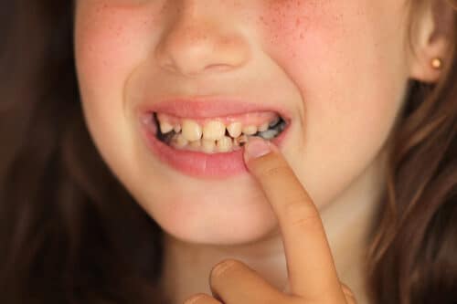 dental tips for kids